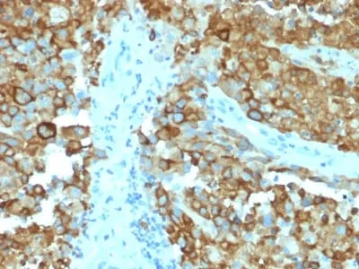 Anti-gp100 / Melanosome / PMEL17 / SILV (Melanoma Marker) (PMEL/2038) - image 1