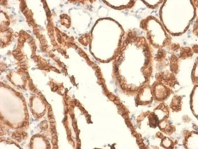 Anti-EpCAM / CD326 (Epithelial Marker) (EGP40/2041R) - image 2