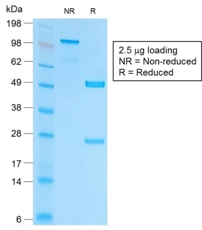 Anti-EpCAM / CD326 (Epithelial Marker) (EGP40/2041R) - image 3