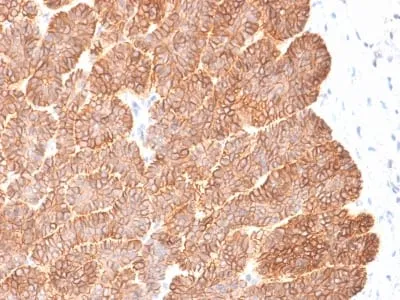 Anti-EpCAM / CD326 (Epithelial Marker) (EGP40/2041R) - image 1
