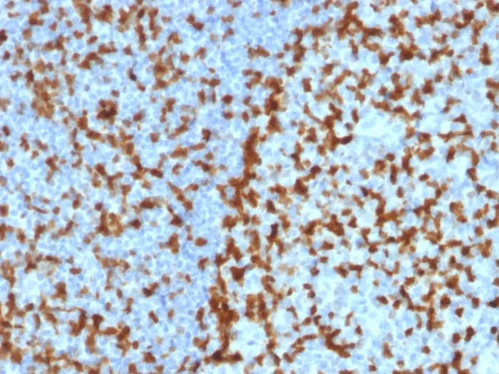 Anti-ZAP70 (Chronic Lymphocytic Leukemia Marker)(ZAP70/2047), CF568 conjugate - image 1