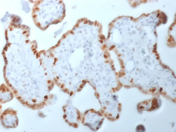 Anti-DNMT1 / DNA Methyltransferase 1(DNMT1/2061) - image 1