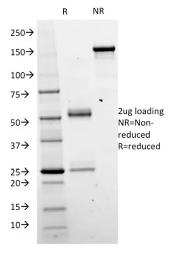 Anti-Catenin, beta (CTNNB1) (CTNNB1/2098) - image 2