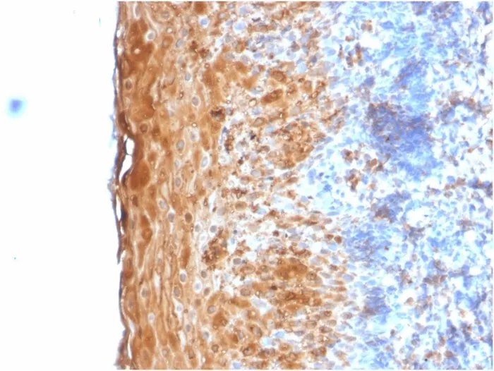 Anti-Involucrin (Squamous Cell Terminal Differentiation Marker)(IVRN/2113R) - image 1