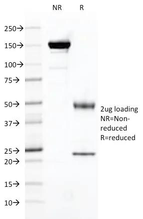Anti-FOLH1 / PSMA (Prostate Epithelial Marker)(FOLH1/2121) - image 1