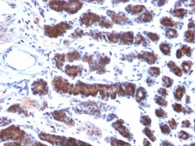 Anti-Mesothelin (Mesothelial Marker) (MSLN/2131) - image 6