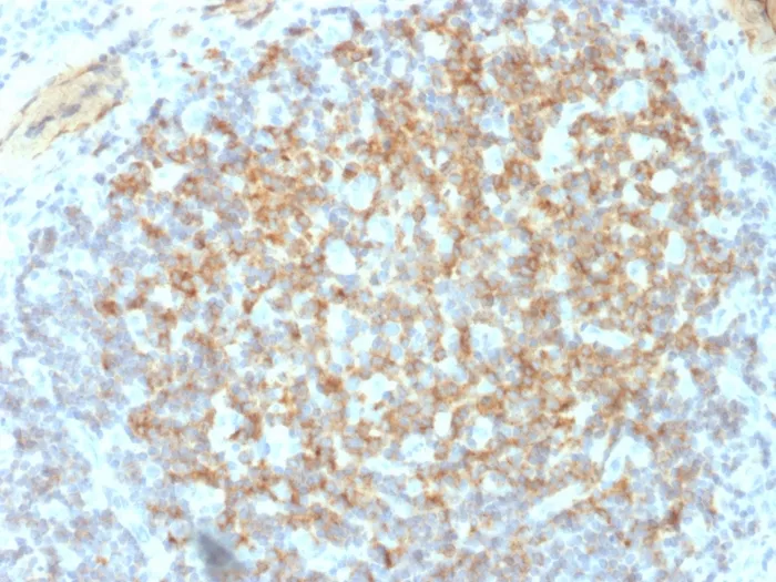 Anti-CD61 / Integrin 3 / Platelet Glycoprotein IIIa (Platelet Marker)(ITGB3/2145) - image 1