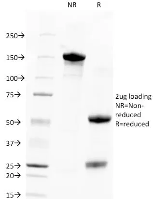 Anti-TACSTD2 / TROP2 (Epithelial Marker) (TACSTD2/2151) - image 3