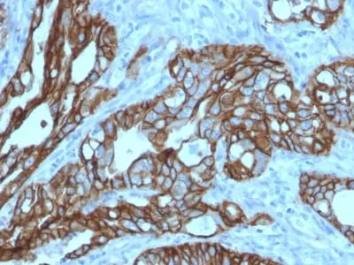 Anti-TACSTD2 / TROP2 (Epithelial Marker) (TACSTD2/2152) - image 1