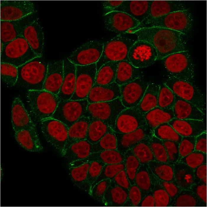 Anti-Catenin, gamma (Cardiomyocyte Marker)(rCTNG/1664) - image 1