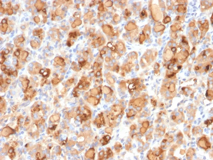 Anti-Thyroglobulin (Thyroidal Cell Marker)(r2H11) - image 1