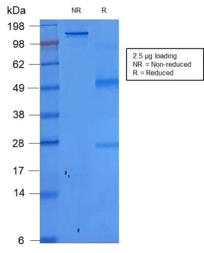 Anti-Ep-CAM / CD326 (Extracellular Domain) (Epithelial Marker) (rEGP40/1372) - image 3
