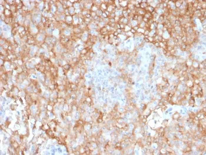 Anti-HLA-DR (MHC II)(TAL 1B5) - image 1