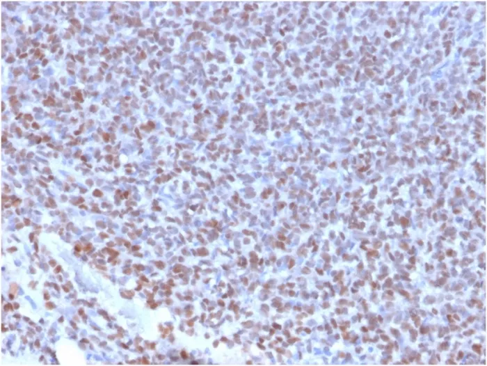 Anti-NKX2.2 (Neuroendocrine & Ewing's Sarcoma Marker)(NX2/2198R), CF594 conjugate - image 1