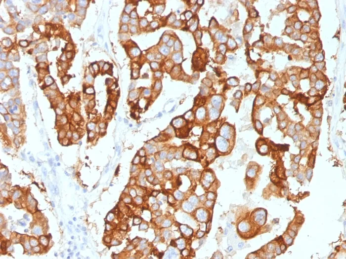 Anti-Cytokeratin 7 (Glandular and Transitional Epithelial Marker)(KRT7/2200) - image 1