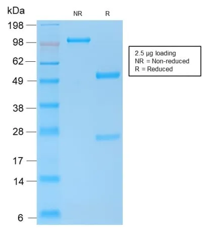 Anti-E-Cadherin (CDH1) / CD324 (Intercellular Junction Marker) (CDH1/2208R) - image 3