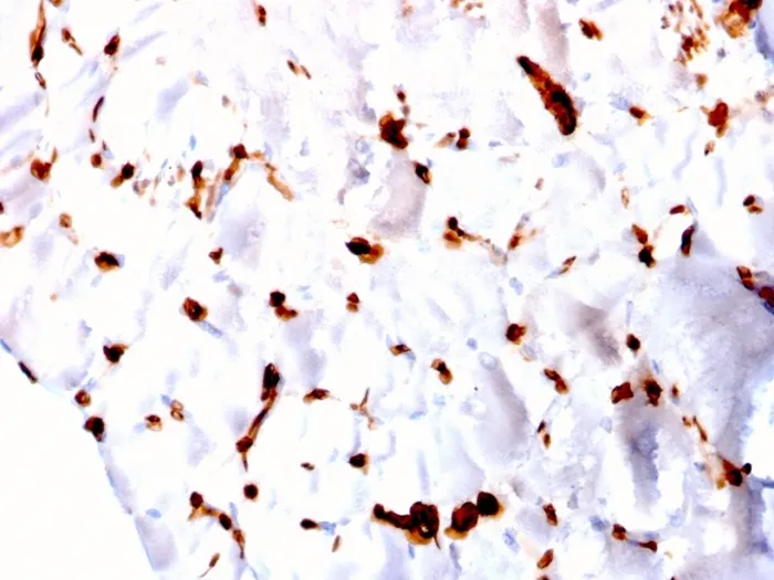 Anti-FABP5 (Marker of Metastatic Potential in Colorectal Cancer)(CPTC-FABP5-3) - image 1