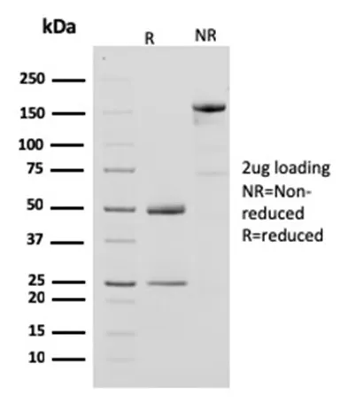 Anti-Creatine Phosphokinase-BB (CK-BB)(CPTC-CKB-2) - image 1