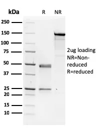 Anti-NME1 / nm23-H1 / NDPK-A (Suppressor of Metastasis)(CPTC-NME1-2), CF647 conjugate - image 1