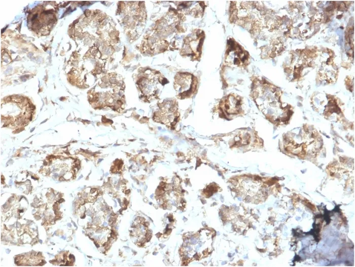Anti-NME2 / nm23-H2 / NDPK-B (Suppressor of Metastasis)(CPTC-NME2-2), CF640R conjugate - image 1