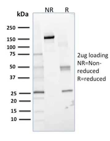 Anti-Lactoylglutathione Lyase(CPTC-GLO1-1), CF568 conjugate - image 1