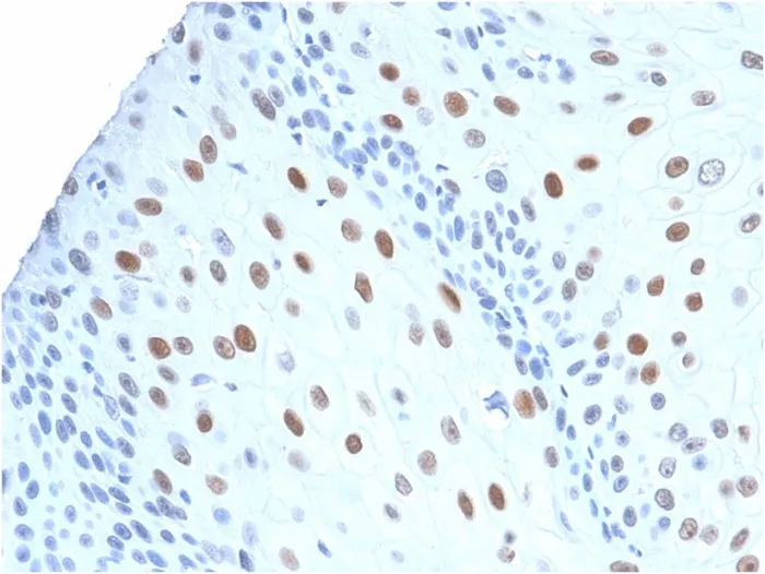 Anti-p21WAF1 (Tumor Suppressor Protein)(CIP1/2275R) - image 1