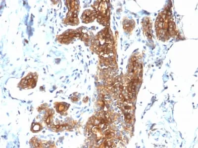 Anti-MUC1 / CA15-3 / EMA / CD227 (Epithelial Marker) (MUC1/2278R) - image 1