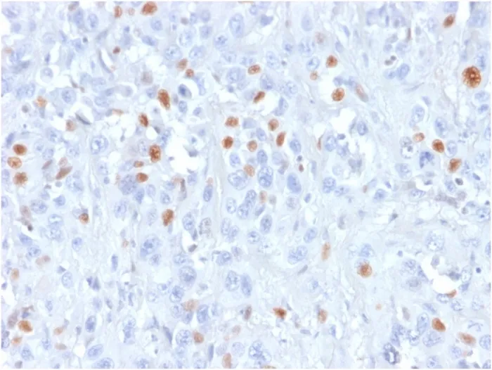 Anti-p21WAF1 (Tumor Suppressor Protein)(rCIP1/823) - image 1