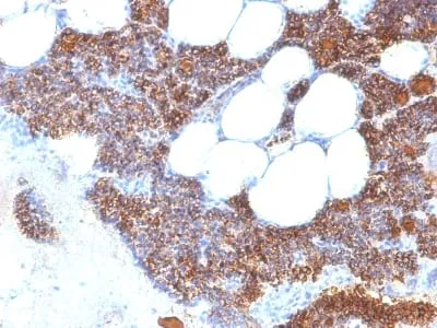 Anti-Parathyroid Hormone (PTH) (N-Terminal) (PTH/2295R) - image 2