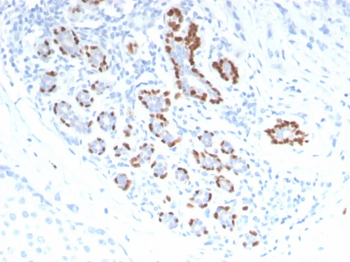 Anti-p40 (deltaNp63) (Squamous, Basal & Myoepithelial Cell Marker) - image 1