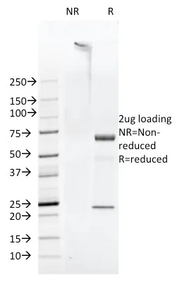 Anti-FAT1 (FAT atypical cadherin 1)(FAT1-3D7/1) - image 1