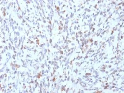 Anti-MyoD1 (Rhabdomyosarcoma Marker) (rMYD712) - image 1
