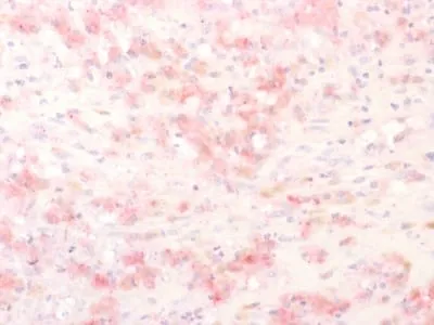 Anti-Tyrosinase-Related Protein-1 (TYRP-1) (Melanoma Marker) (TYRP1/2340R) - image 2