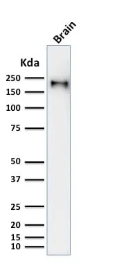 Anti-Neurofilament (NF-H) (Neuronal Marker) (rNF421) - image 3