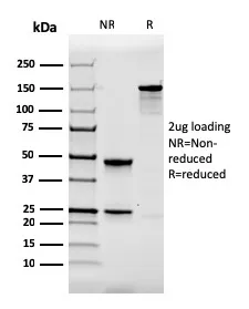 Anti-Calbindin 1 (CALB1)(CALB1/2364) - image 1
