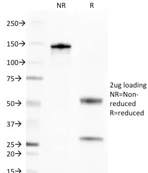 Anti-CD269 / TNFRSF17 / BCMA (B-Cell Maturation Protein) (BCMA/2366) - image 2