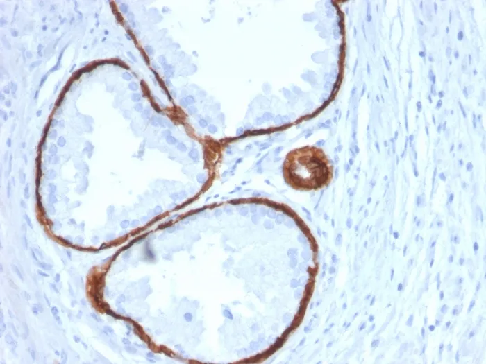 Anti-Cytokeratin 14 (KRT14) (Squamous Cell Marker)(KRT14/2375) - image 1