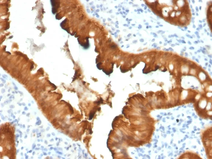 Anti-Villin (GI-Mucosal & Urogenital Brush Border Marker)(VIL1/2376) - image 1