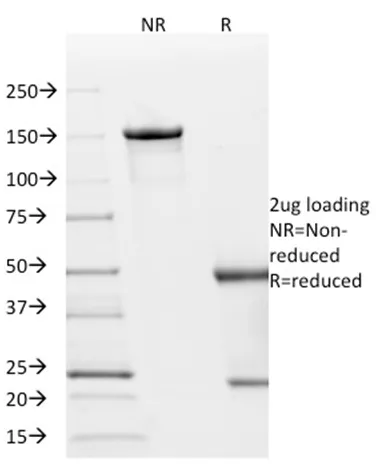 Anti-p21WAF1 (Tumor Suppressor Protein)(AC8) - image 1