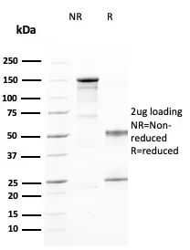 Anti-CD25 / IL2RA (Activated Lymphocyte Marker)(IL2RA/2394) - image 1