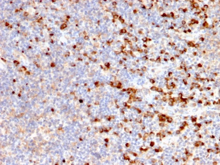Anti-TIM3 / HAVCR2 / CD366 (Effector T-Cell Marker)(HAVCR2/192) - image 1
