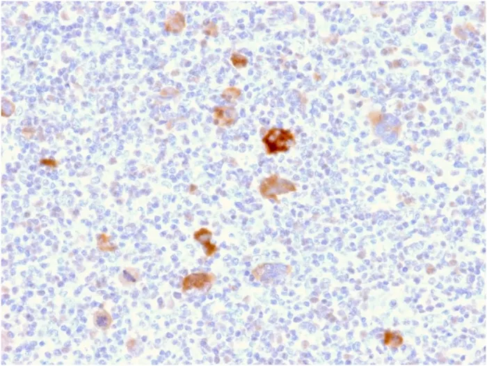 Anti-Bcl-X (Apoptosis Marker)(BCL2L1/2406) - image 1