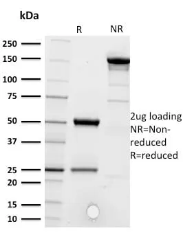 Anti-CD5 (Mantle Cell Lymphoma Marker) (CD5/2416) - image 2