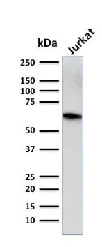 Anti-CD5 (Mantle Cell Lymphoma Marker) (CD5/2416) - image 3