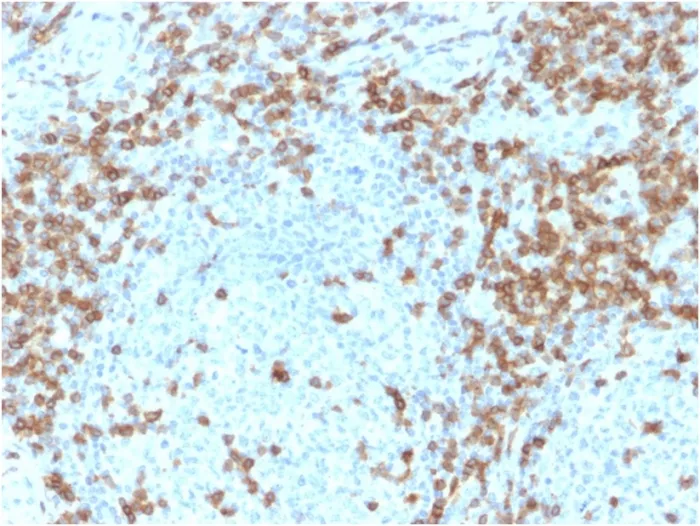 Anti-CD5 (Mantle Cell Lymphoma Marker)(CD5/2418), Biotin conjugate - image 1