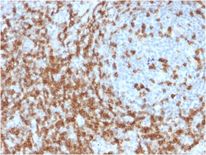 Anti-CD5 (Mantle Cell Lymphoma Marker)(CD5/2419), CF647 conjugate - image 1