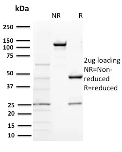 Anti-BAP1 (BRCA1 Associated Protein 1)(BAP1/2431) - image 1
