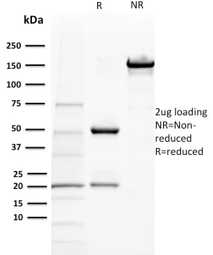 Anti-BAP1 (BRCA1 Associated Protein 1)(BAP1/2432) - image 1