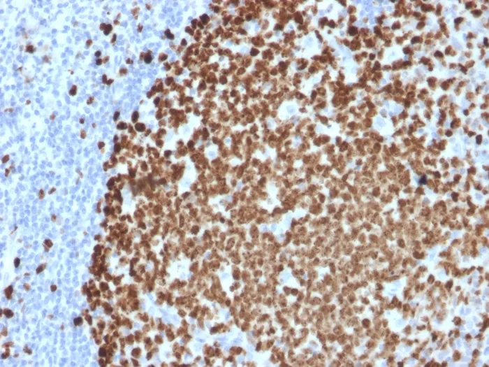 Anti-Ki-67 (Proliferating Cell Marker)(MKI67/2461) - image 1