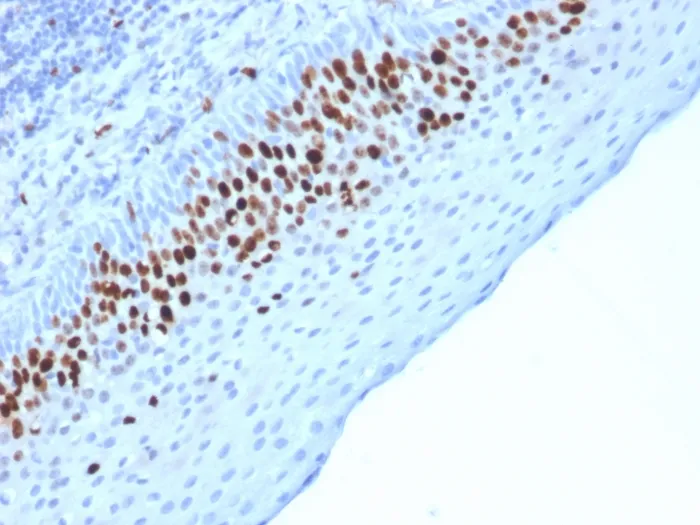 Anti-Ki-67 (Proliferating Cell Marker)(MKI67/2463) - image 1